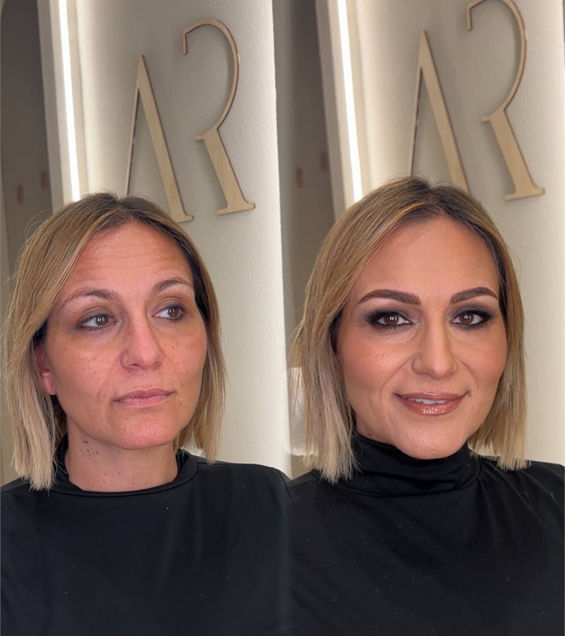 Risultato trattamento